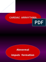 ECG Arrhythmia