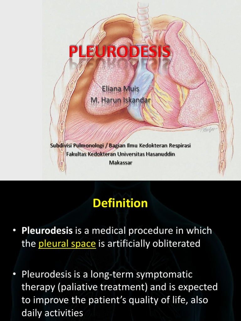 Pleurodesis Diseases And Disorders Medicine