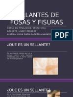 Sellantes de Fosas y Fisuras