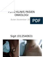 Foto Klinis Pasien Onkologi November Fix