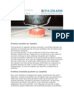 Types de dentiers