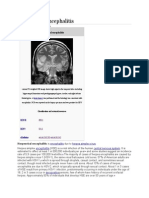 Herpes Encephalitis