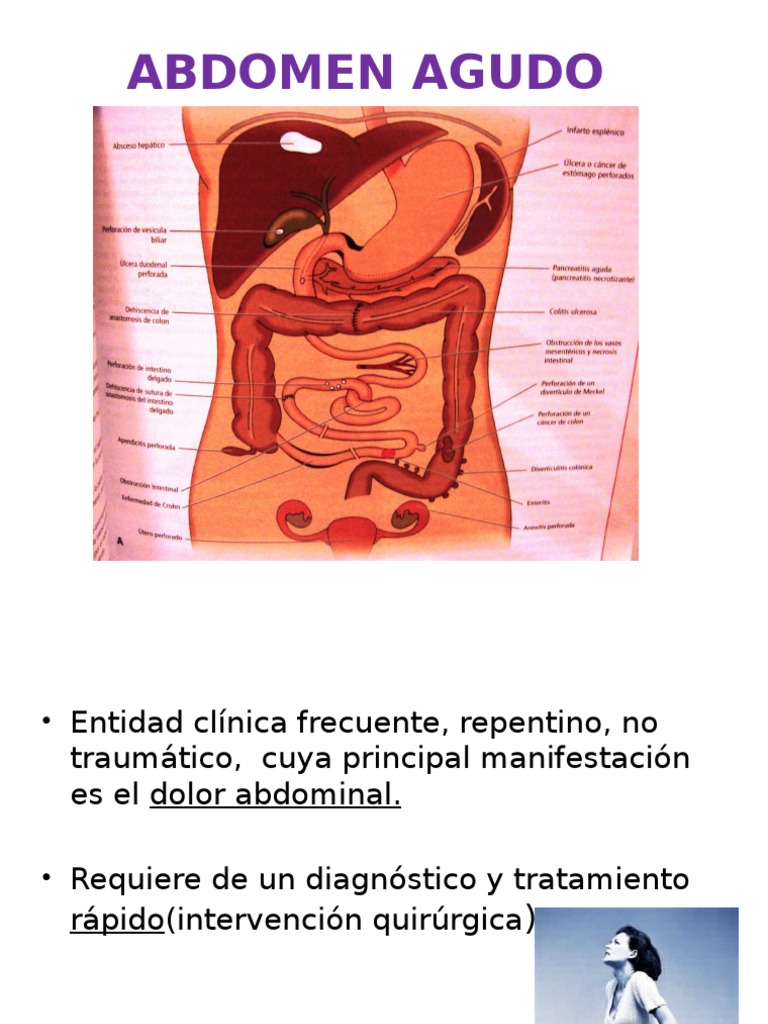 Abdomen Agudo Abdomen Dolor
