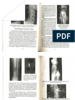 3.1.Tabloul Radiologic Al Tumorilor Osteogene