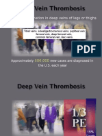 Deep Vein Thrombisis