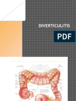 Diverticulitis Sam