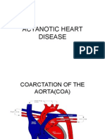 Acynotic Disease