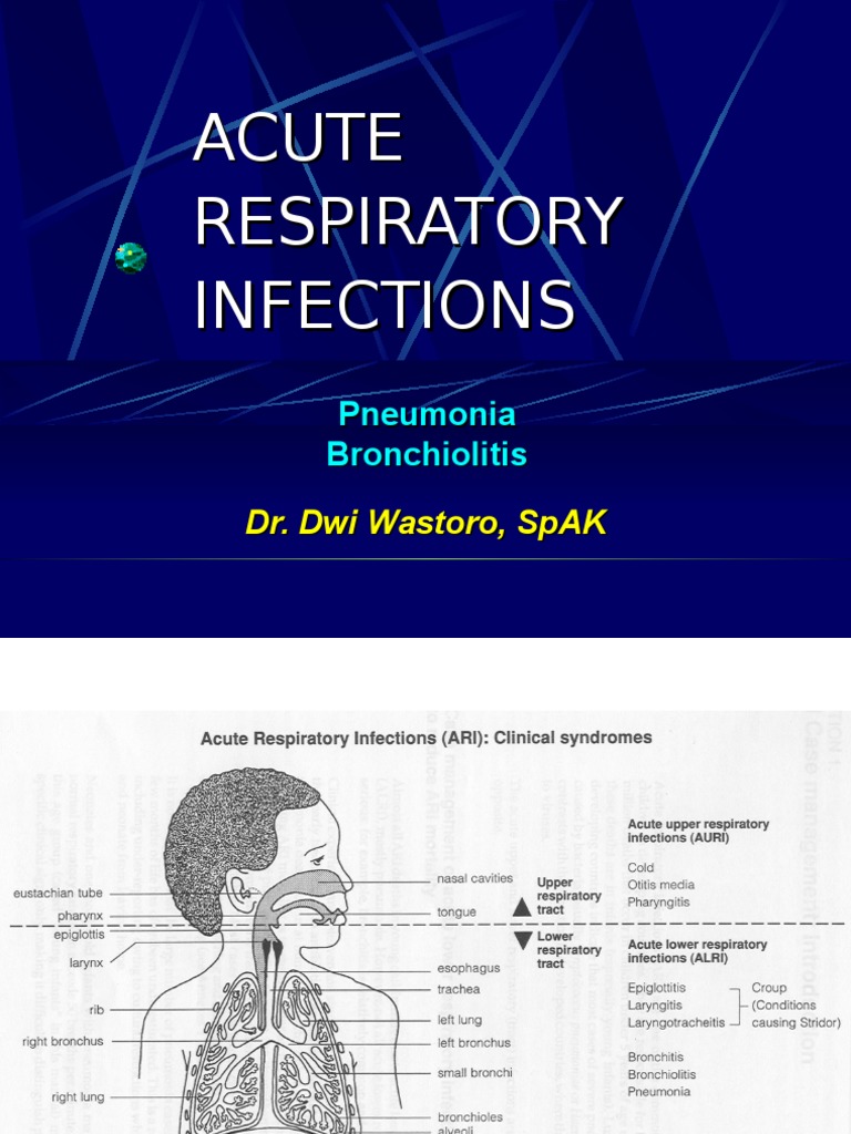 Acute Respiratory Infections Overview | PDF | Pneumonia | Microbiology