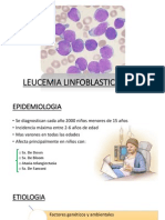 Leucemia Linfoblastica Aguda
