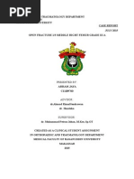 Download Complete Case femur shaft fracture by ArHam SN275390863 doc pdf