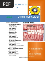 Download Bab II Pembahasan Gigi Impaksi Kelompok i Bedah Mulut Kedokteran Gigi Unsri by ade irawan SN27547187 doc pdf