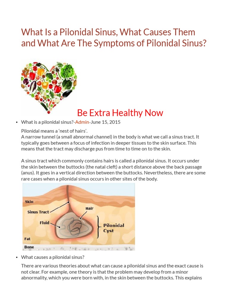 Understanding Pilonidal Sinus Conditions | PDF | Surgery | Wound