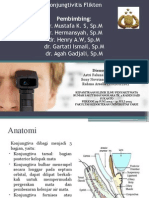 Konjungtivitis Flikten Fix