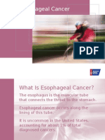 Esophageal+Cancer+2015