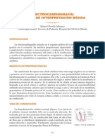 Electrocardiogram A