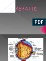 Keratitis PPT Presentasi