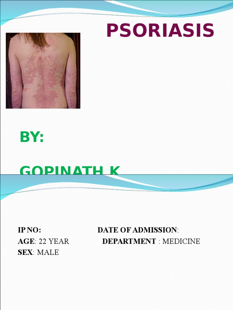 Psoriasis Case Study and Management | PDF | Self-Improvement | Wellness