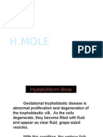 Hydatidiform Mole