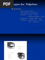 Aula 2  - patologias das palpebras.pdf