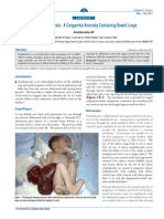 AMJI 02 Web Case Report Giant Omphalocele Congenital Anomaly Containing Bowel Loops