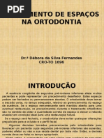 Fechamento de Espaços Em Ortodontia