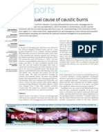 Case Reports: An Unusual Cause of Caustic Burns