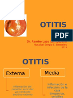 Otitis Media