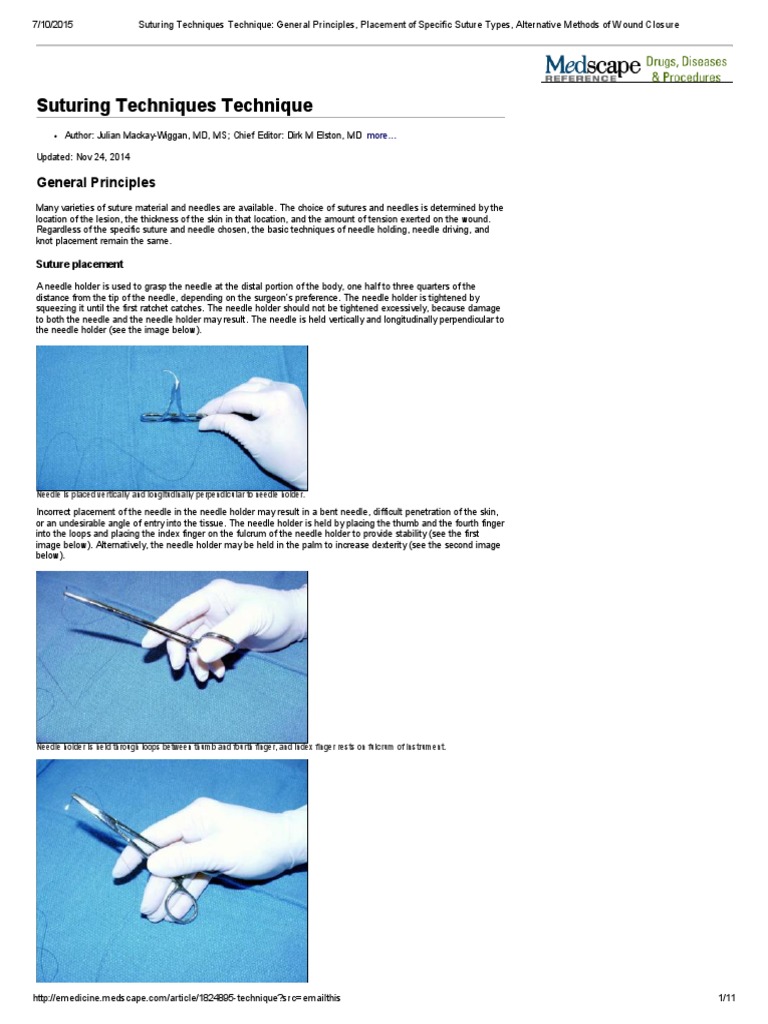 Suturing Techniques Technique - General Principles, Placement of ...