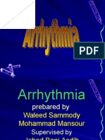 Arrhythmia