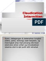 Claudication Intermitten