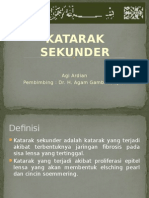 Katarak