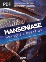 Hanseniase Avancos e Desafios