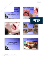 Organization of Tongue Movements Before and After Frenotomy For Posterior Tongue-Tie: An Ultrasound Analysis