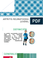 Artritis Reumatoidea Juvenil