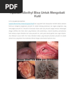 Download Apakah Albothyl Bisa Untuk Mengobati Kutil by FianAdiBowo SN277328764 doc pdf