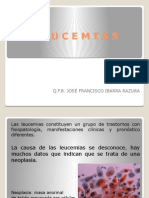 (1) LEUCEMIAS, GENERALIDADES