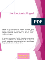 Frenillectomia Lingual