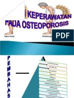 Ppt Osteoporosis lansia by ika yes