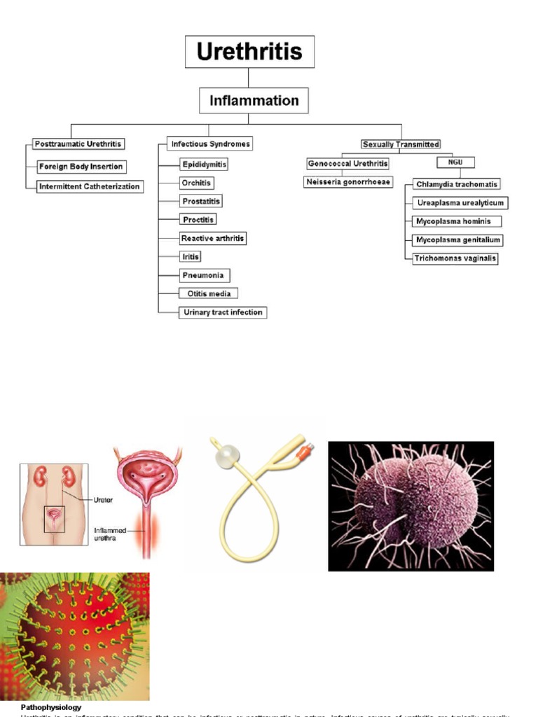 Urethritis Pathophysiology Urinary Tract Infection Genitourinary System Diseases