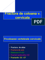 Fract Cervicale