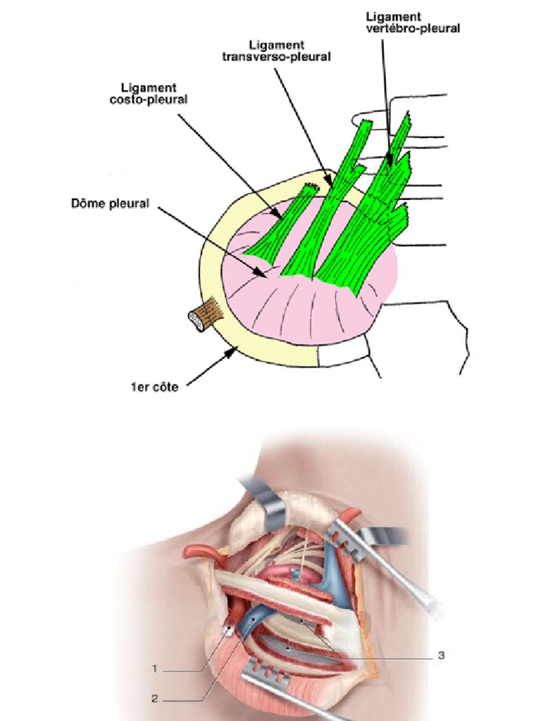 Dome Pleural | PDF