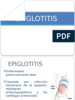 Epiglotitis 