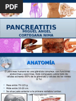 Download Pancreatitis by Jair Eduardo De Jesus Crisanto Barreto SN278064571 doc pdf