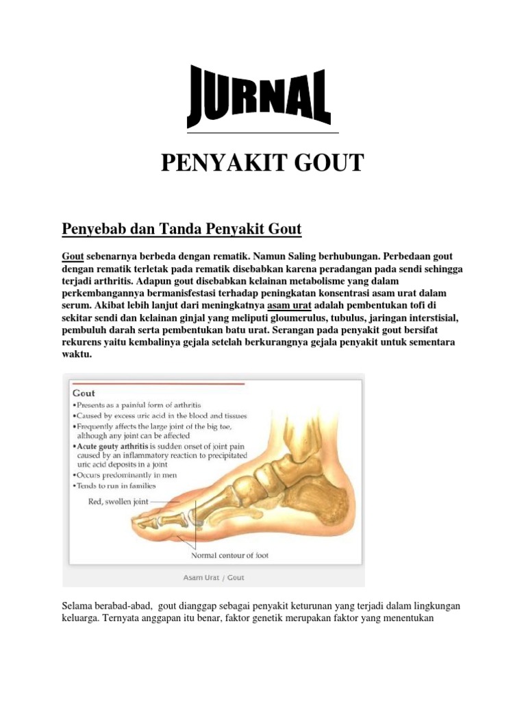 Jurnal Penyakit Gout.pdf
