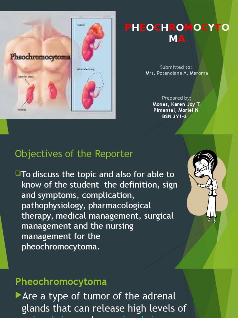 Pheochromocytoma Presentation Epinephrine Endocrine System