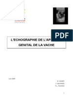 Poly Echographie