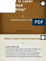 What Is Laser Assisted Hatching