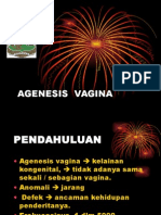Agenesis Vagina