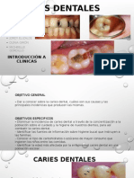 Caries dentales: causas, prevención y factores de riesgo