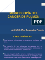 Microscopía Del Cáncer de Pulmón